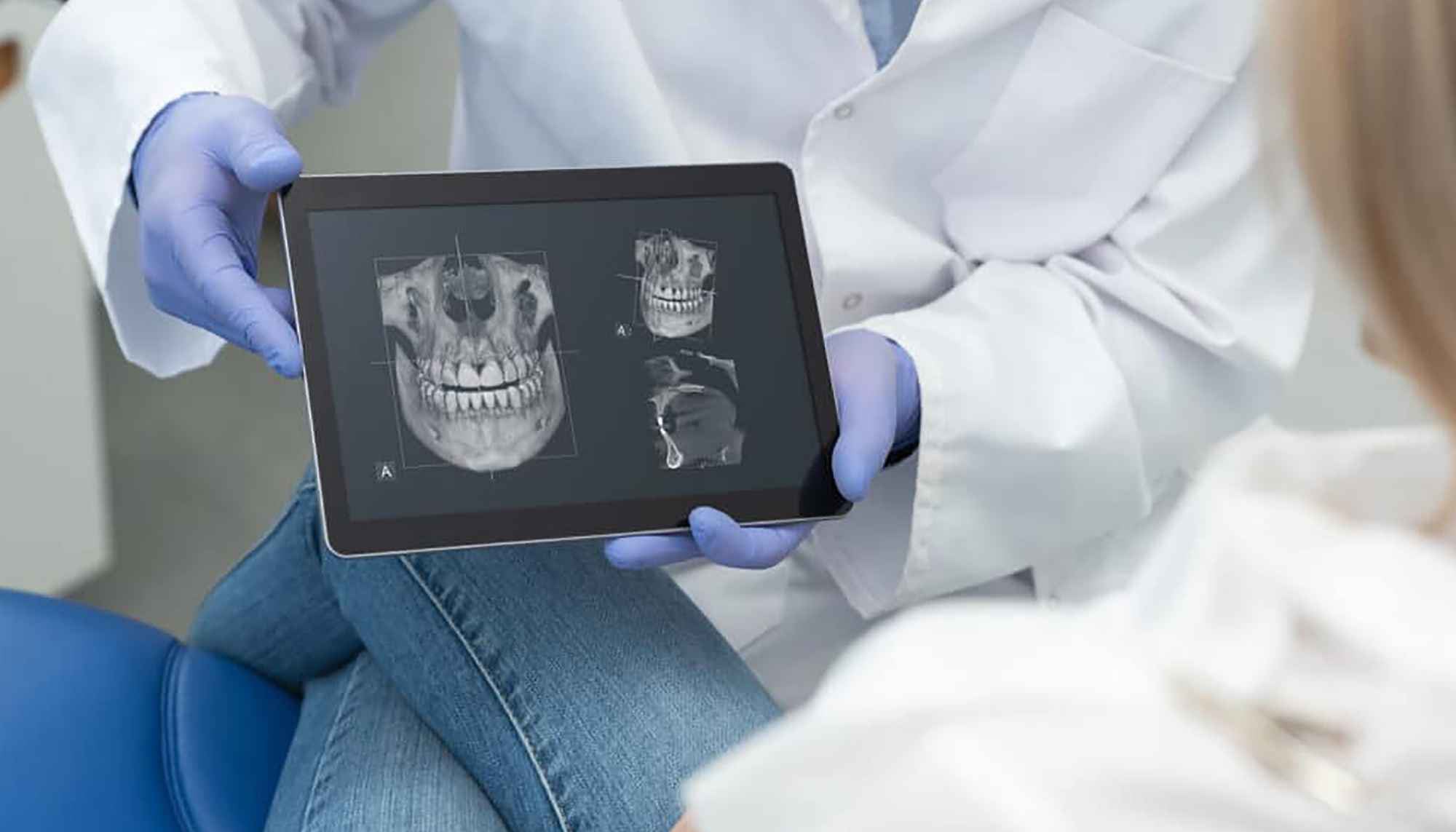 3D-corrective-jaw-surgery-planning-1024x684_11zon-min