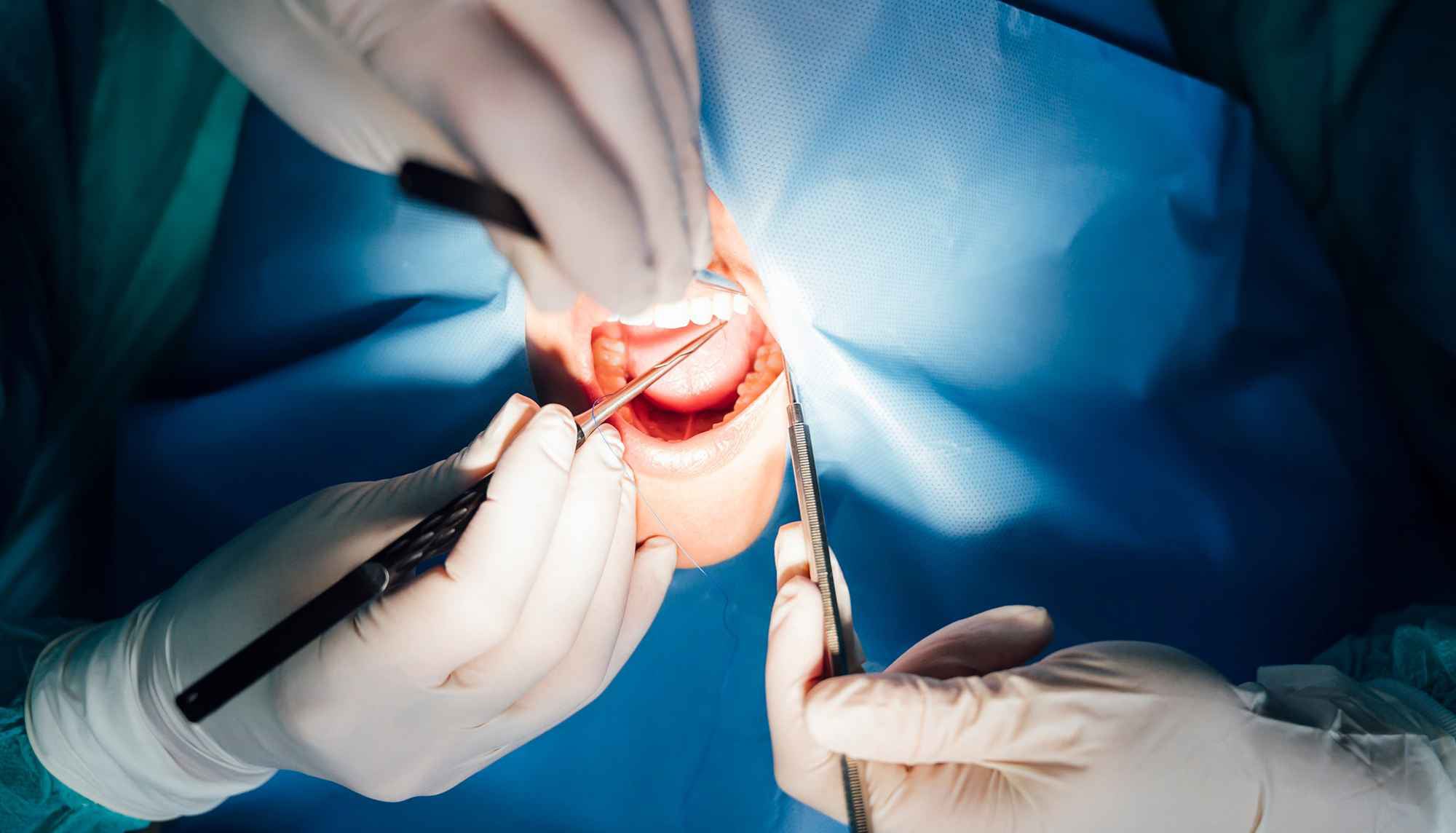 721a1216-91a0-4bfa-abb6-320673da13fa_11zon-min